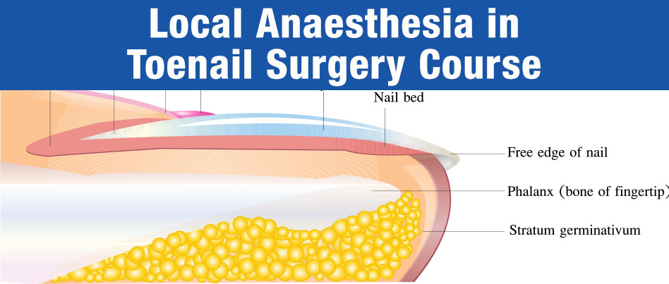 Postgraduate Diploma Toenail Surgery